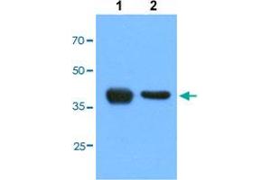 Western blot analysis of Lane 1: HepG2 cells, Lane 2: HeLa cells with ACAT1 monoclonal antibody, clone AT2C5  at 1:1000 dilution. (ACAT1 抗体  (AA 34-427))
