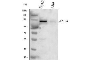 Western blot analysis of EML4 using anti-EML4 antibody (ABIN6719384).