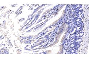Detection of APC in Rat Small intestine Tissue using Polyclonal Antibody to Adenomatosis Polyposis Coli Protein (APC) (APC 抗体  (AA 2634-2842))