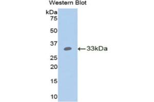 Western blot analysis of the recombinant protein. (ANGPTL4 抗体  (AA 183-401))