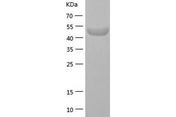 PKNOX1 Protein (AA 1-436) (His tag)