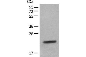 Western blot analysis of Mouse eye tissue lysate using CRYGS Polyclonal Antibody at dilution of 1:800 (CRYGS 抗体)