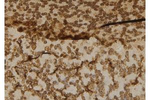 ABIN6277016 at 1/100 staining Mouse brain tissue by IHC-P. (Cbl Proto-Oncogene B, E3 Ubiquitin Protein Ligase (CBLB) (N-Term) 抗体)