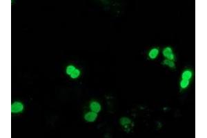 Image no. 2 for anti-Synovial Sarcoma, X Breakpoint 1 (SSX1) antibody (ABIN1501157) (SSX1 抗体)
