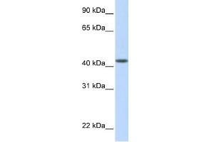 WB Suggested Anti-DENND1B Antibody Titration: 0. (DENND1B 抗体  (N-Term))