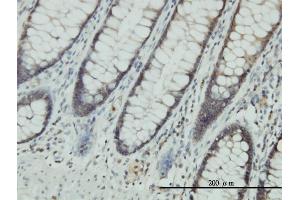 Immunoperoxidase of monoclonal antibody to CLIC1 on formalin-fixed paraffin-embedded human colon. (CLIC1 抗体  (AA 1-241))