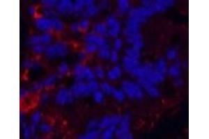 Immunofluorescence analysis of Mouse colon tissue using KIF7 Monoclonal Antibody at dilution of 1:200. (KIF7 抗体)