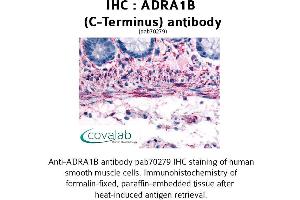 Image no. 1 for anti-Adrenergic, alpha-1B-, Receptor (ADRA1B) (C-Term), (Cytoplasmic Domain) antibody (ABIN1731575)