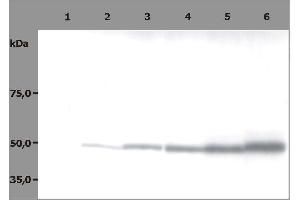 Western Blotting analysis (reducing conditions) of HPB-ALL human peripheral blood leukemia cell line. (TUBB 抗体)