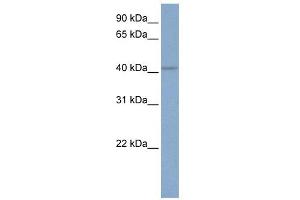 KCNN4 antibody used at 1 ug/ml to detect target protein. (KCNN4 抗体  (C-Term))