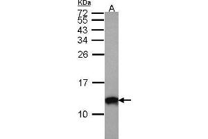 WB Image Sample (30 ug of whole cell lysate) A: A431 , 15% SDS PAGE antibody diluted at 1:1000 (S100A10 抗体)