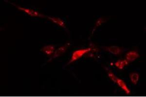 ABIN6278583 staining  HuvEc cells by IF/ICC. (IP6K2 抗体  (Internal Region))