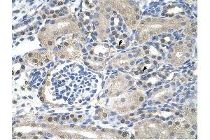 NXF1 antibody was used for immunohistochemistry at a concentration of 4-8 ug/ml to stain Epithelial cells of renal tubule (arrows) in Human Kidney. (NXF1 抗体  (N-Term))