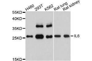 Western blot analysis of extracts of various cell lines, using IL6 antibody (ABIN4904048) at 1:1000 dilution. (IL-6 抗体)