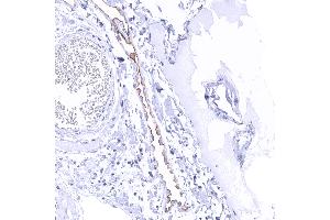 Distinct Upk3b immunostaining of apical membranes of peritoneal mesothelial cells (Uroplakin 3B 抗体)