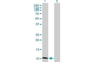 Western Blot analysis of GHRH expression in transfected 293T cell line by GHRH MaxPab polyclonal antibody. (GHRH 抗体  (AA 1-108))