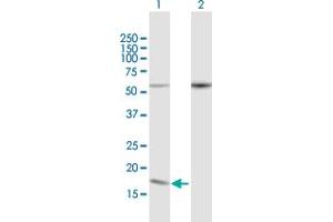 Western Blot analysis of PDCD5 expression in transfected 293T cell line by PDCD5 MaxPab polyclonal antibody. (PDCD5 抗体  (AA 1-125))
