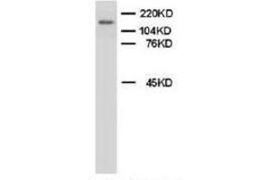 Western blot analysis of rat brain tissue lysis using Myeloperoxidase antibody (Myeloperoxidase 抗体  (C-Term))
