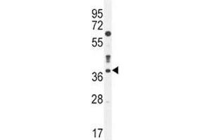 Caspase-3 antibody western blot analysis in MDA-MB435 lysate