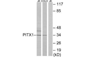 Western blot analysis of extracts from Jurkat cells and COLO cells, using PITX1 antibody. (PITX1 抗体  (Internal Region))