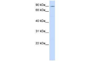 Western Blotting (WB) image for anti-ATPase, Ca++ Transporting, Type 2C, Member 1 (ATP2C1) (C-Term) antibody (ABIN2781847)