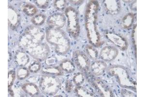 DAB staining on IHC-P; Samples: Human Kidney Tissue (ICA1 抗体  (AA 1-258))