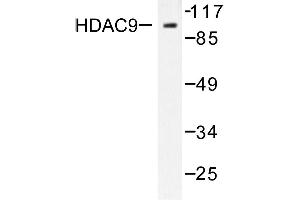 Image no. 2 for anti-Histone Deacetylase 9 (HDAC9) antibody (ABIN265461) (HDAC9 抗体)