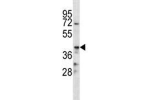 Western Blotting (WB) image for anti-CD86 (CD86) (AA 269-298) antibody (ABIN3030429)