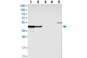 Western blot analysis of Lane 1: RT-4, Lane 2: U-251 MG, Lane 3: Human Plasma, Lane 4: Liver, Lane 5: Tonsil with PAWR polyclonal antibody  at 1:250-1:500 dilution. (PAWR 抗体)