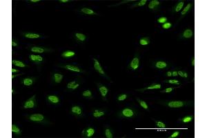 Immunofluorescence of monoclonal antibody to NBEA on HeLa cell.