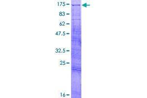 TAO Kinase 3 Protein (TAOK3) (AA 1-898) (GST tag)