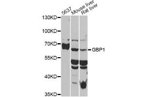 Western blot analysis of extracts of various cell lines, using GBP1 antibody (ABIN5972062) at 1/1000 dilution. (GBP1 抗体)