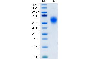 Human B7-H6 on Tris-Bis PAGE under reduced condition. (B7-H6 Protein (AA 25-262) (His tag))