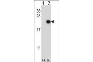 Western blot analysis of EIF4EBP1 (arrow) using rabbit polyclonal EIF4EBP1 Antibody (Center) (ABIN656558 and ABIN2845820). (eIF4EBP1 抗体  (AA 31-61))