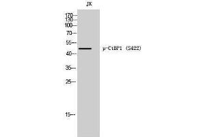 Western Blotting (WB) image for anti-C-terminal Binding Protein 1 (CTBP1) (pSer422) antibody (ABIN3182694) (CTBP1 抗体  (pSer422))