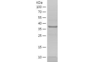 Western Blotting (WB) image for Secreted and Transmembrane 1 (SECTM1) (AA 69-248) protein (His-IF2DI Tag) (ABIN7124999) (SECTM1 Protein (AA 69-248) (His-IF2DI Tag))