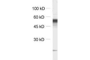 dilution: 1 : 1000, sample: unboiled synaptic membrane fraction of rat brain (LP1)
