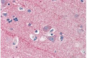 Human Brain, Cortex (formalin-fixed, paraffin-embedded) stained with ICAM5 antibody ABIN337181 at 5 ug/ml followed by biotinylated anti-goat IgG secondary antibody ABIN481715, alkaline phosphatase-streptavidin and chromogen. (ICAM5 抗体  (AA 909-920))