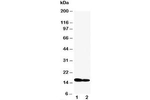 Western blot testing of IFITM1 antibody and Lane 1:  SW620