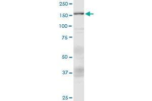 Western Blotting (WB) image for anti-Additional Sex Combs Like 1 (ASXL1) (AA 1-84) antibody (ABIN792966) (ASXL1 抗体  (AA 1-84))