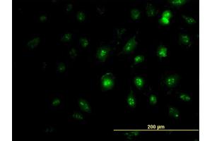 Immunofluorescence of monoclonal antibody to ZIC4 on HeLa cell. (ZIC4 抗体  (AA 249-319))