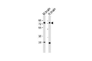 All lanes : Anti-Nr4a2 Antibody (Center) at 1:2000 dilution Lane 1: mouse brain lysates Lane 2: rat brain lysates Lysates/proteins at 20 μg per lane.
