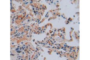 Used in DAB staining on fromalin fixed paraffin- embedded Kidney tissue (TNFAIP3 抗体  (AA 1-300))