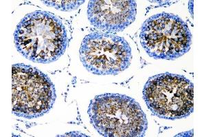 IHC analysis of DDX4 using anti-DDX4 antibody (ABIN7601203). (DDX4 抗体  (AA 3-666))