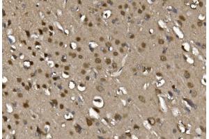 IHC analysis of MEF2C using anti-MEF2C antibody (ABIN6719606).