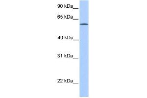 ACSBG2 antibody used at 1 ug/ml to detect target protein. (ACSBG2 抗体  (Middle Region))