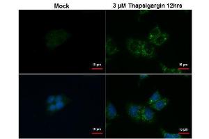 Immunofluorescence (IF) image for anti-Sequestosome 1 (SQSTM1) antibody (ABIN2854836)
