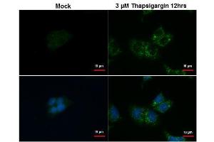 ICC/IF Image SQSTM1 antibody [N3C1], Internal detects SQSTM1 protein at autophagosome by immunofluorescent analysis. (SQSTM1 抗体)