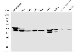 Western blot analysis of NMI using anti-NMI antibody (ABIN6719489).