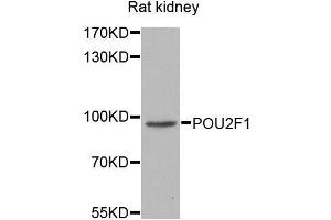Western blot analysis of extracts of various cell lines, using POU2F1 antibody. (POU2F1 抗体  (AA 15-290))
